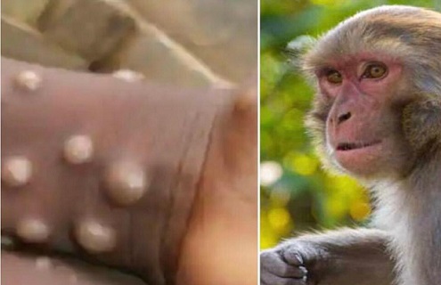 آماده‌باش سازمان بهداشت جهانی برای مقابله با شیوع عمدی «آبله میمون»/احتمال سرایت بیماری از طریق «روابط جنسی»