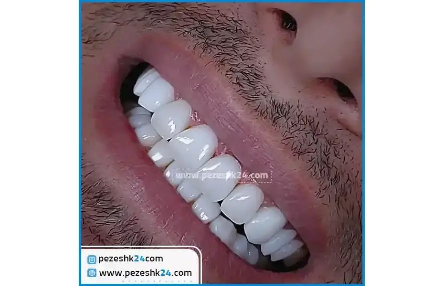 بهترین کلینیک دندانپزشکی تهران با قیمت مناسب