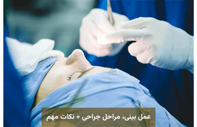 عمل بینی، مراحل جراحی + معرفی جراح بینی